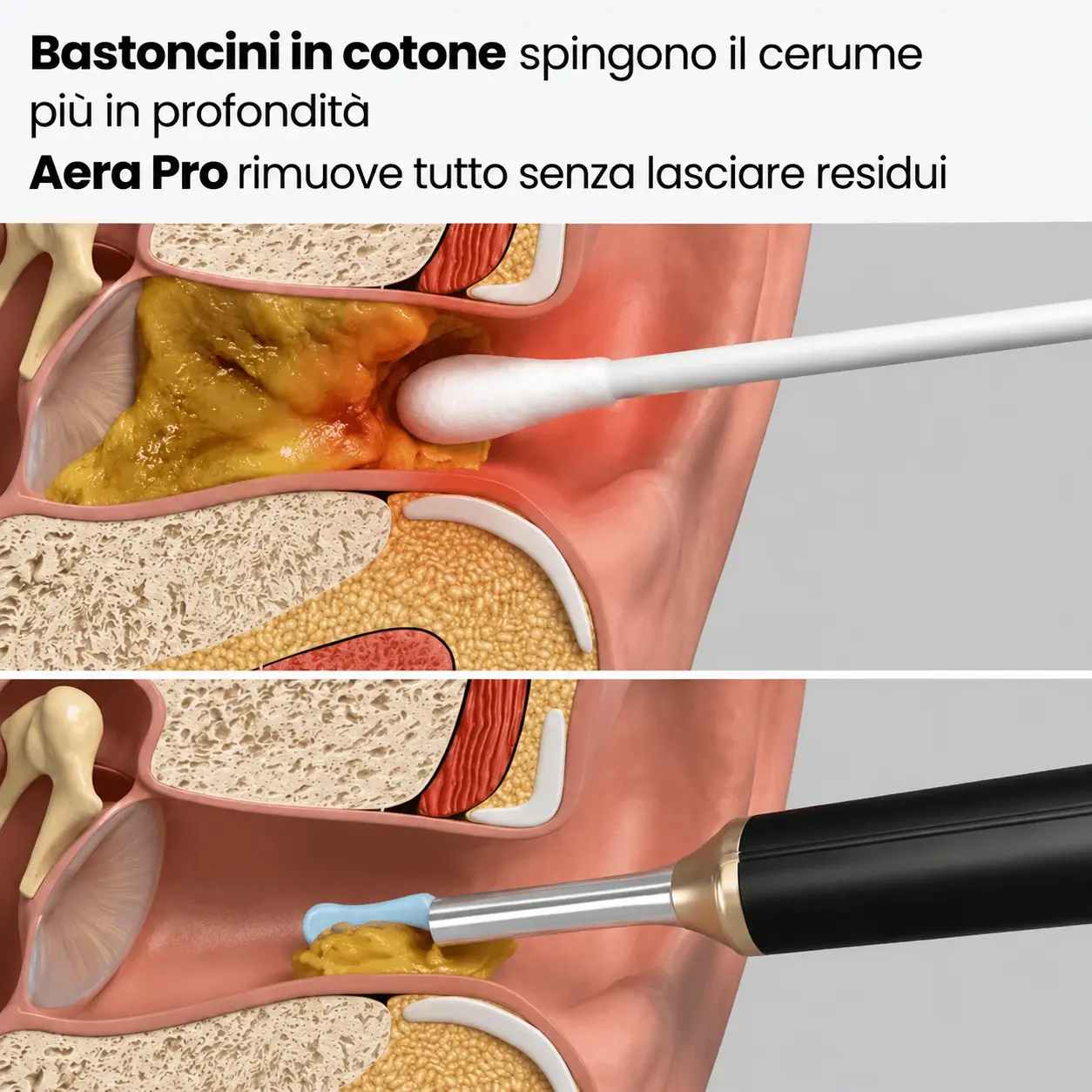 Aera Pro™